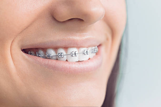 Best Invisalign and Clear Aligners  in Myrtle Grove, FL